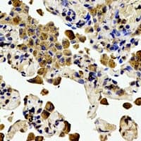 BCL2 / Bcl-2 Antibody (phospho-Thr56)
