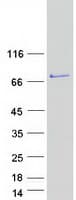 Human FERMT1 / Kindlin Protein (Recombinant Myc-DDK (Flag))