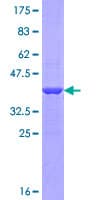 Human PADI1 Protein (Recombinant GST, N-terminus)