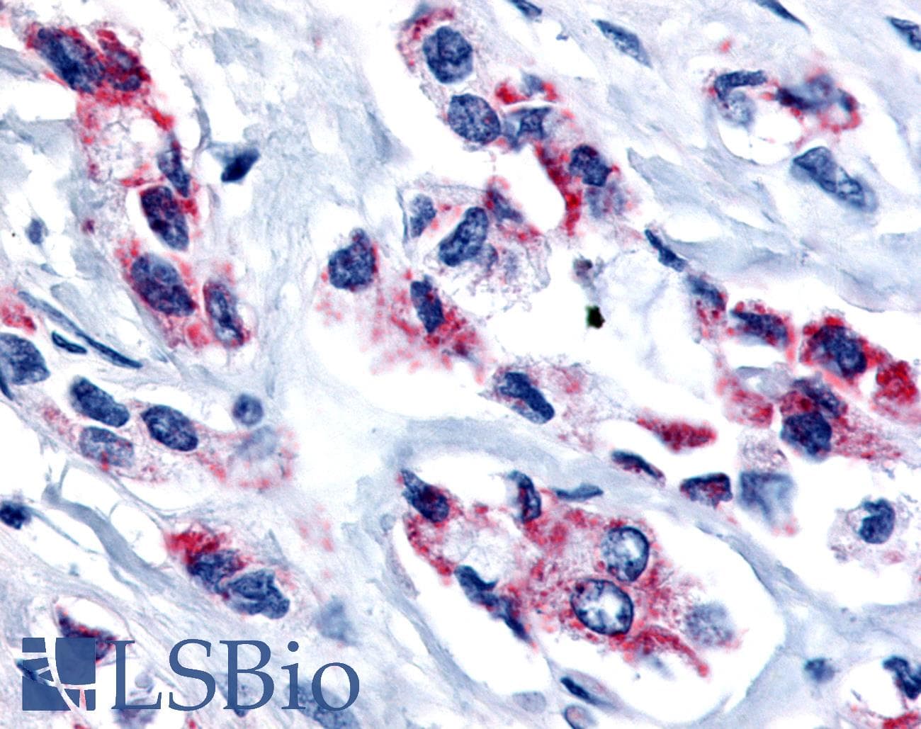 PathPlus™ ESRRB / ERR Beta Antibody (Internal)