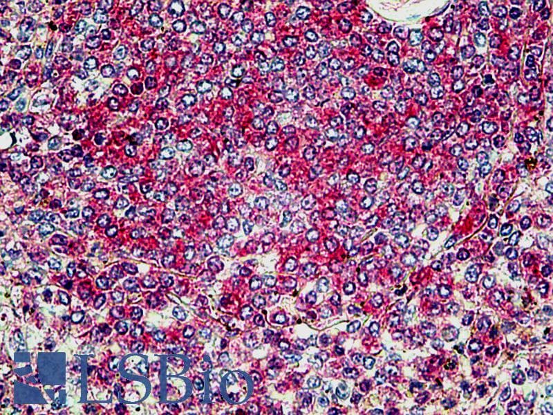 IHC-plus™ SNX4 Antibody (aa438-450)