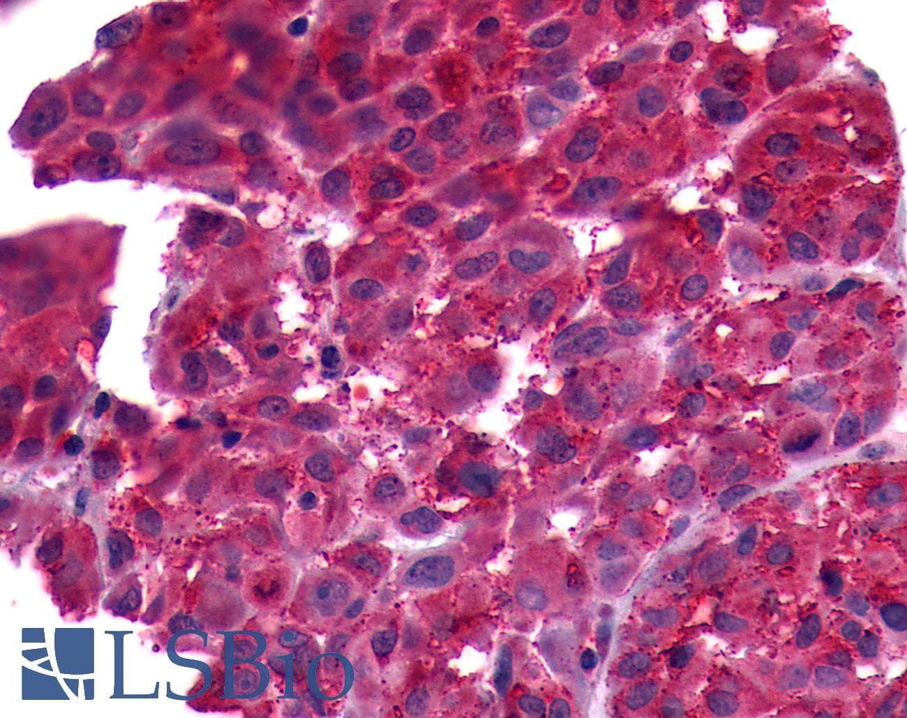 PathPlus™ FP / PTGFR Antibody (Extracellular Domain)