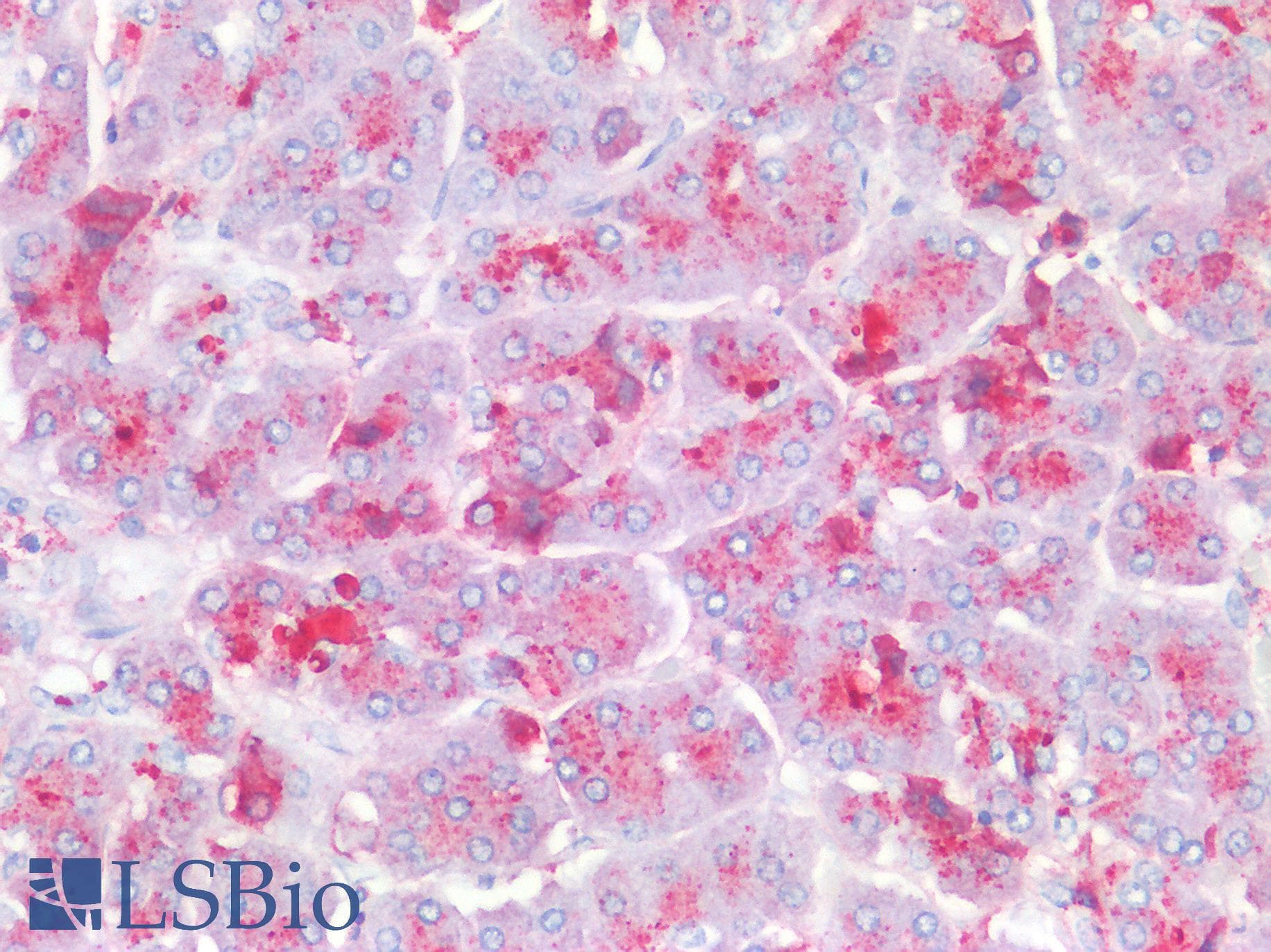 IHC-plus™ Polyclonal Rabbit anti-Human PRSS1 / Trypsin Antibody (IHC, IF, WB)