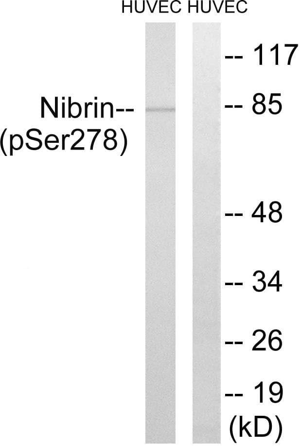 NBN / Nibrin Antibody (phospho-Ser278)