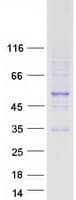Human PAX2 Protein (Recombinant Myc-DDK (Flag))