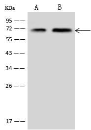 CTDSPL2 Antibody