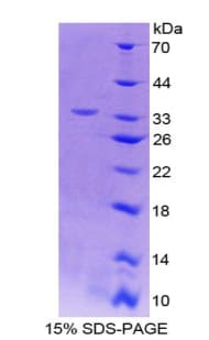 Mouse IL12B / IL12 p40 Protein (Recombinant His-T7)