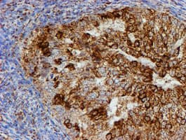 PSMB9 Antibody (clone OTI1G7)
