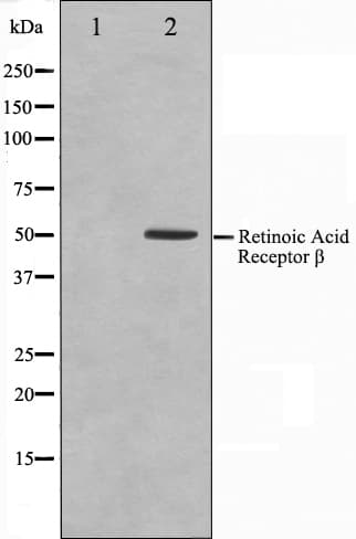 RARB / RAR Beta Antibody