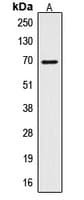 Polyclonal Rabbit anti-Human CTPS Antibody (N-Terminus, IHC, WB)