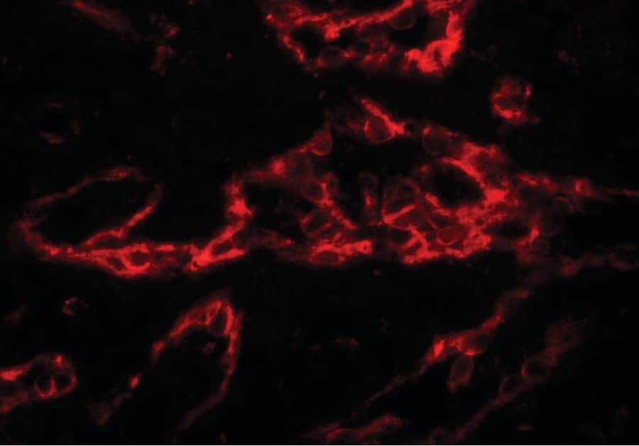 IHC-plus™ Polyclonal Rabbit anti-Human PTRF / CAVIN Antibody (IHC, IF, WB)