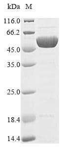 Clostridium botulinum Botulinum Neurotoxin type B Protein (Recombinant 10His, N-terminus + Myc, C-terminus)