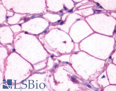 PathPlus™ ADRB3 Antibody (N-Terminus)