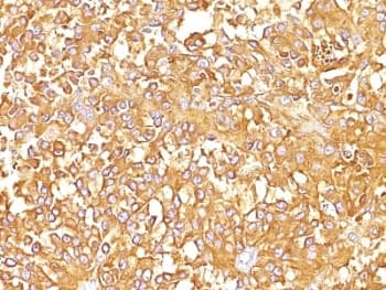 PMEL / SILV / gp100 Antibody (clone SPM142)
