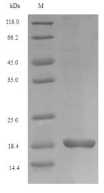 Euroglyphus maynei EURM2 Protein (Recombinant 6His, N-terminus)