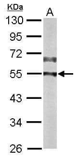 IHC-plus™ CAMK2D / CaMKII Delta Antibody (aa249-445)