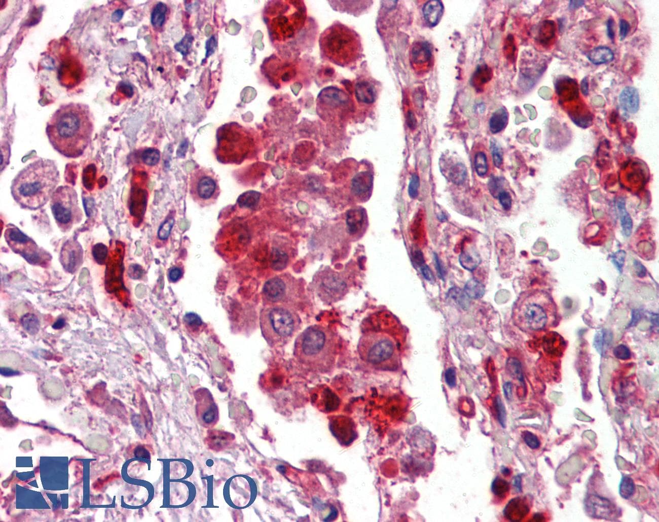 IHC-plus™ Polyclonal Goat anti-Human S100A9 / MRP14 Antibody (aa67-79, IHC, WB)