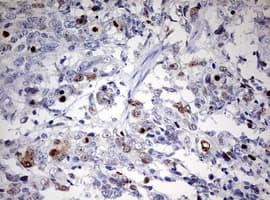 Monoclonal Mouse anti-Human TOP2A / Topoisomerase II Alpha Antibody (clone OTI2F8, aa1100-1531, IHC, WB)