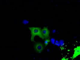 BTK Antibody (clone OTI6H9)