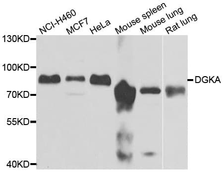 DGKA Antibody