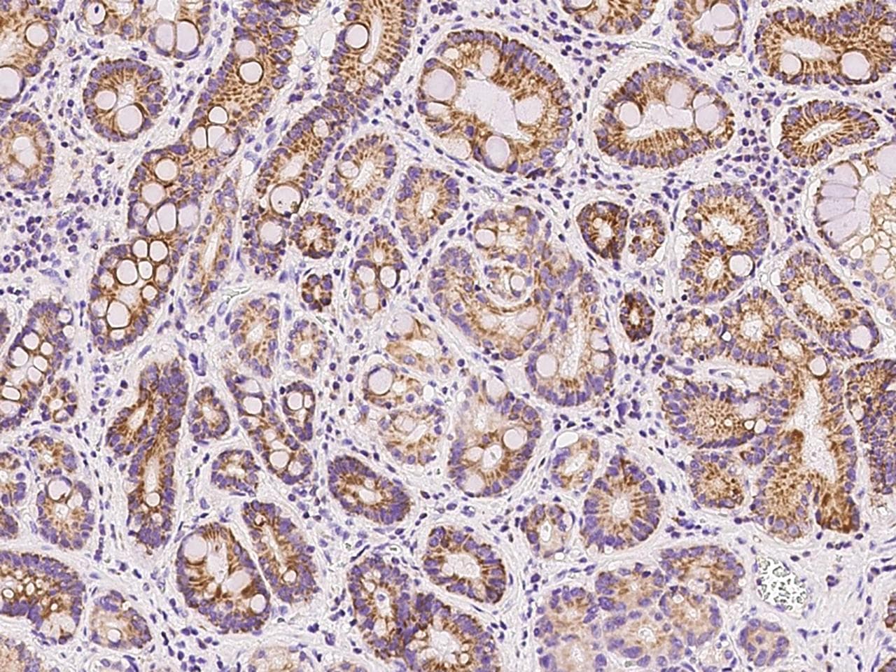 Polyclonal Rabbit anti-Human COXIV / COX4 Antibody (Preservative Free, IHC, WB)