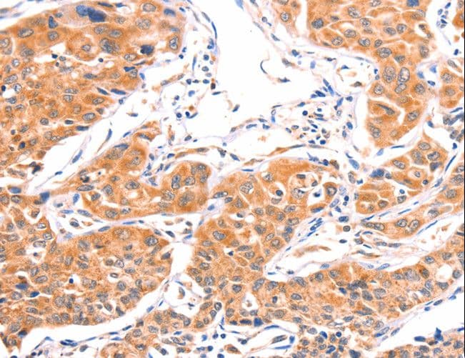 AMPD1 Antibody