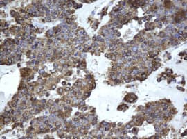 EPHX1 / Epoxide Hydrolase 1 Antibody (clone OTI3F10)
