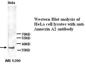 IHC-plus™ ANXA2 / Annexin A2 Antibody (N-Terminus)