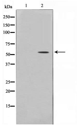 Polyclonal Rabbit anti-Human TP53 / p53 Antibody (phospho-Ser15, IHC, WB)