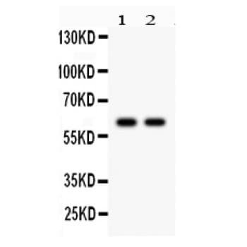 Polyclonal Rabbit anti-Human CYP1B1 Antibody (aa255-480, IHC, WB)