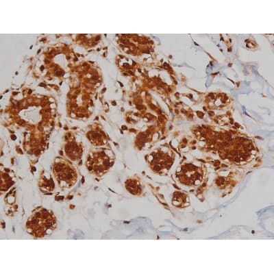 IGF1R / IGF1 Receptor Antibody (phospho-Tyr1346)