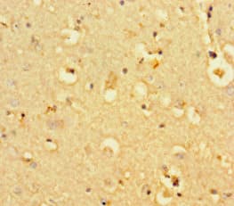 BCL11B Antibody