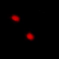Polyclonal Rabbit anti-Human CDKN1C / p57 Kip2 Antibody (IHC, IF, WB)