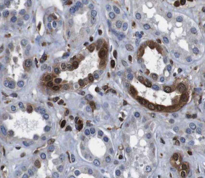 Polyclonal Rabbit anti-Human ANXA1 / Annexin A1 Antibody (IHC, WB)