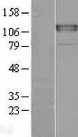CHERP Protein (Over-Expression Lysate Myc-DDK (Flag))
