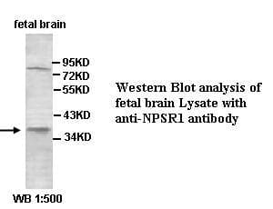 NPSR1 / NPSR / GPR154 Antibody (aa241-300)