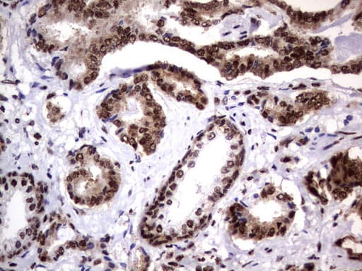 DDX56 Antibody (aa323-547, clone UMAB153)