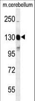 c-Kit / CD117 Antibody (Tyr703)