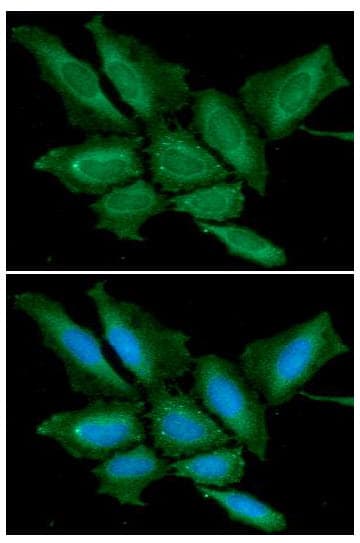 BPGM Antibody (clone AT2E11)