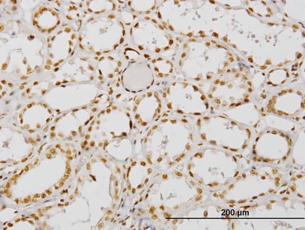 Monoclonal Mouse anti-Human ARA70 / NCOA4 Antibody (clone 1F11, IHC, IF, WB)