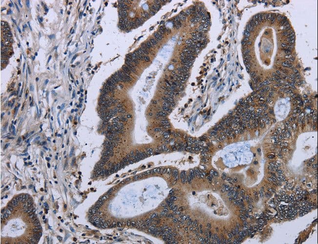 ITGAE / CD103 Antibody
