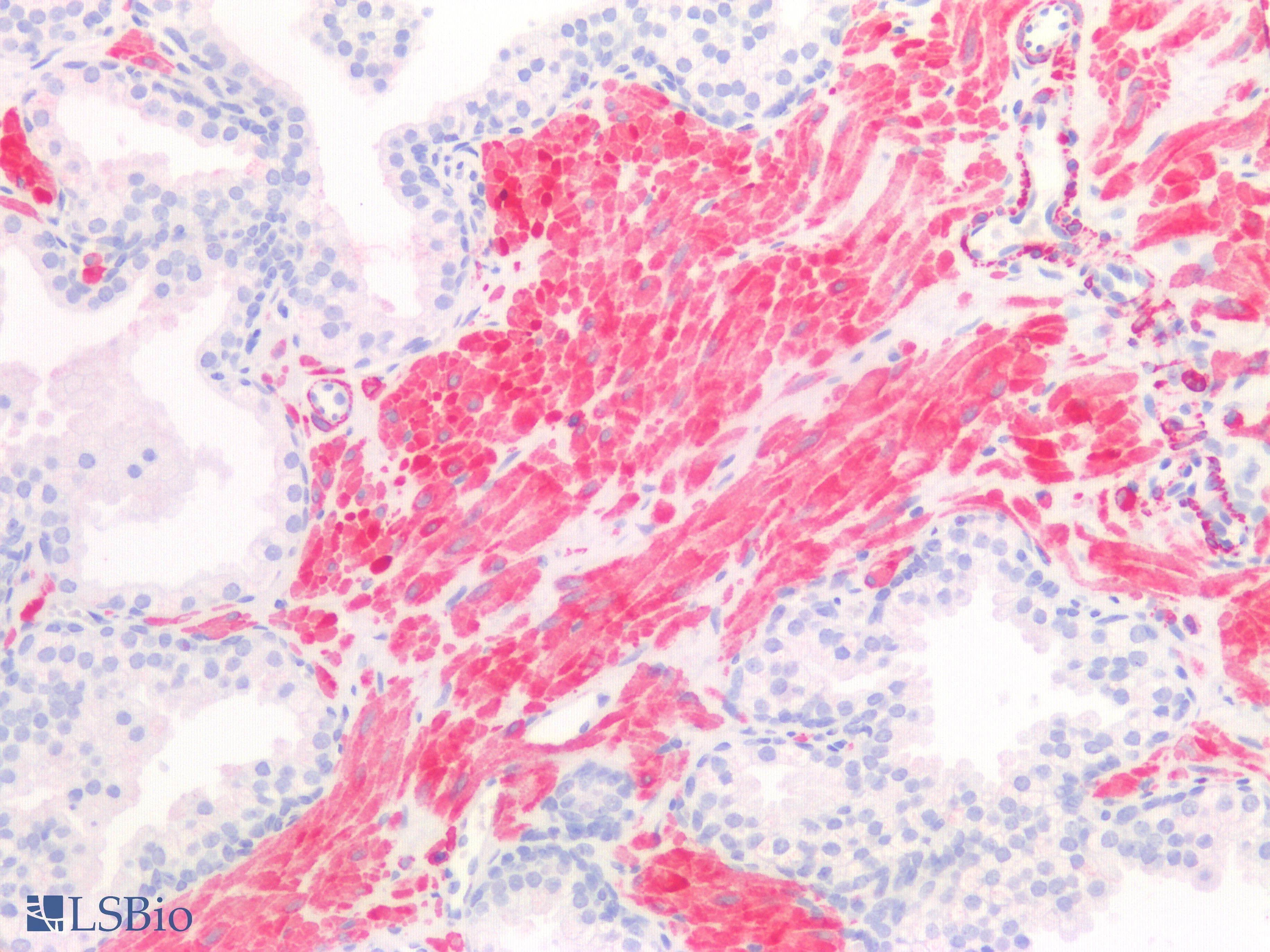 PathPlus™ Monoclonal Mouse anti-Human Myosin, Smooth Muscle Antibody (IHC)