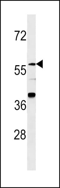 Polyclonal Rabbit anti-Human ZNF776 Antibody (aa41-68, WB)