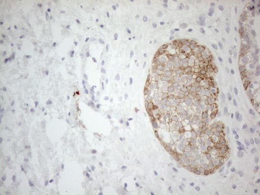 ERBB3 / HER3 Antibody (aa983-1342, clone OTI3C1)
