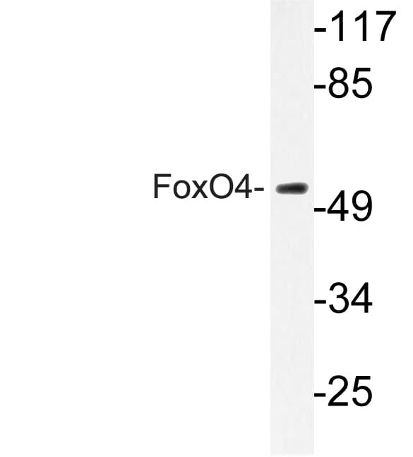 Polyclonal Rabbit anti-Human FOXO4 / AFX1 Antibody (Lys447, IF, WB)