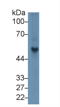FGB / Fibrinogen Beta Chain Antibody (aa33-479)