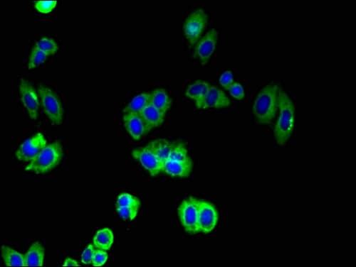 CDH2 / N Cadherin Antibody