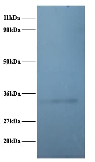 IHC-plus™ RPL5 / Ribosomal Protein L5 Antibody