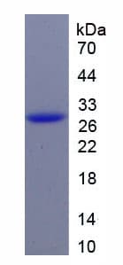 Human Basigin / Emmprin / CD147 Protein (Recombinant His-T7)