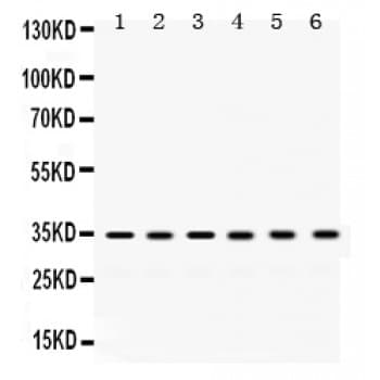 Polyclonal Rabbit anti-Human SULT2A1 / Sulfotransferase 2A1 Antibody (aa253-285, IHC, WB)